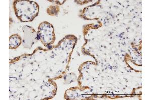 Immunostaining (ISt) image for anti-Hydroxyprostaglandin Dehydrogenase 15-(NAD) (HPGD) (AA 1-266) antibody (ABIN516680)