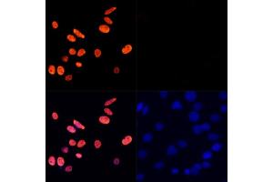 Immunofluorescence analysis of C6 cells treated by TSA (upper left) and untreated C6 cells (upper right) using Acetyl-Histone H3-K27 Rabbit pAb (red, ABIN7267670) at dilution of 1:100.