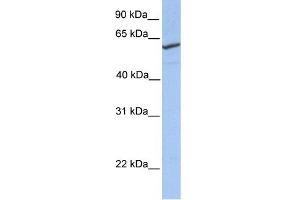 WB Suggested Anti-RFT1 Antibody Titration: 0.