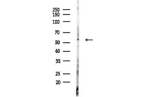 anti-GTPase Activating Protein (SH3 Domain) Binding Protein 2 (G3BP2) (C-Term) antibody