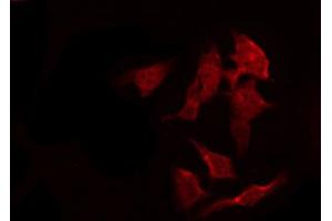 ABIN6267261 staining SK-OV3 by IF/ICC.