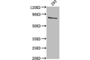 Western Blot Positive WB detected in: 293 whole cell lysate All lanes: TBK1 antibody at 1:2000 Secondary Goat polyclonal to rabbit IgG at 1/50000 dilution Predicted band size: 84 kDa Observed band size: 84 kDa (TBK1 Antikörper  (AA 644-661))