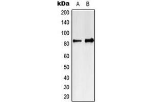 Western blot analysis of MARK4 expression in Jurkat (A), K562 (B) whole cell lysates. (MARK4 Antikörper  (Center))