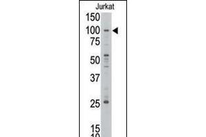 Western blot analysis of anti-MLLT10 Pab in Jurkat cell line lysate. (MLLT10 Antikörper  (C-Term))