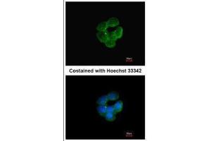 ICC/IF Image Immunofluorescence analysis of methanol-fixed A431, using NNT, antibody at 1:200 dilution. (NNT Antikörper  (C-Term))