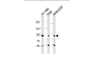 All lanes : Anti-DEF Antibody (N-term) at 1:2000 dilution Lane 1: HT-1080 whole cell lysate Lane 2: K562 whole cell lysate Lane 3: RI 8226 whole cell lysate Lysates/proteins at 20 μg per lane. (ZC3H18 Antikörper  (N-Term))