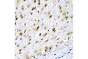 Immunohistochemistry of paraffin-embedded mouse brain using TPH2 antibody (ABIN5974298) at dilution of 1/200 (40x lens). (Tryptophan Hydroxylase 2 Antikörper)