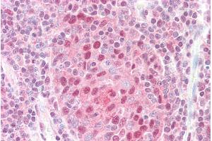 Immunohistochemistry (IHC) image for anti-G Protein Pathway Suppressor 1 (GPS1) (C-Term) antibody (ABIN184996)