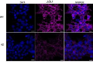 Immunocytochemical staining of HeLa cells using LLGL1 antibody (ABIN7799250), 1:1,000), Top panel: wild-type (WT), Bottom panal: LLGL1 shRNA knockdown (KD).