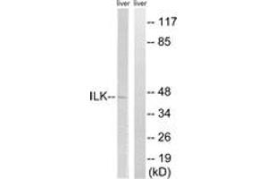 Western blot analysis of extracts from rat liver cells, using ILK (Ab-246) Antibody. (ILK Antikörper  (AA 212-261))