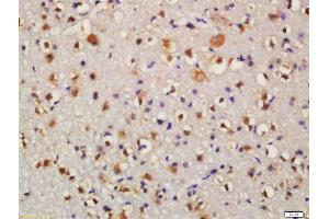 Formalin-fixed and paraffin embedded mouse brain labeled with Anti-Bid Polyclonal Antibody, Unconjugated  at 1:200 followed by conjugation to the secondary antibody and DAB staining (BID Antikörper  (AA 102-195))