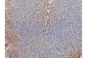 Immunohistochemistry (IHC) image for anti-LIM Domain Kinase 1 (LIMK1) (pThr508) antibody (ABIN6255701)