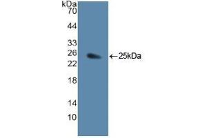 Western blot analysis of recombinant Human JAG1. (JAG1 Antikörper  (AA 836-1047))