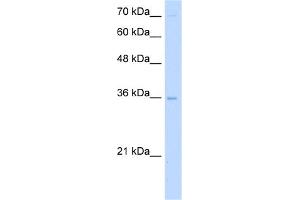 WB Suggested Anti-PRIM2 Antibody Titration:  5. (PRIM2 Antikörper  (Middle Region))