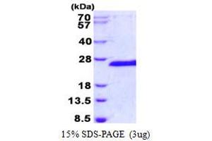 Image no. 1 for E3 Ubiquitin-Protein Ligase SIAH1 (SIAH1) protein (His tag) (ABIN1098362) (SIAH1 Protein (His tag))