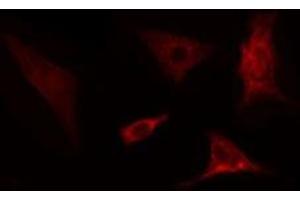 ABIN6275702 staining  COLO205 cells by IF/ICC. (SLC39A4 Antikörper  (Internal Region))
