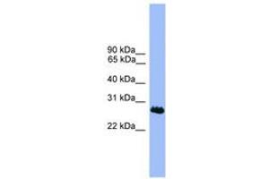 Image no. 1 for anti-Chromosome 1 Open Reading Frame 216 (C1ORF216) (AA 51-100) antibody (ABIN6746103)