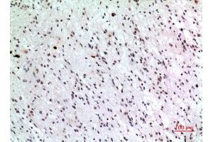 Immunohistochemistry (IHC) analysis of paraffin-embedded Human Brain, antibody was diluted at 1:100. (P57 (Ser24) Antikörper)