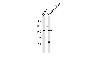 ZFPM1 Antikörper  (C-Term)