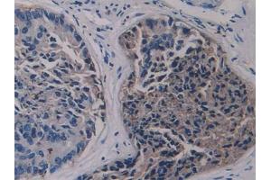 Used in DAB staining on fromalin fixed paraffin- embedded kidney tissue (LSR Antikörper  (AA 335-589))