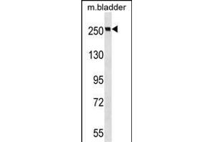MYH9 Antibody (N-term ) (ABIN6243267 and ABIN6577348) western blot analysis in mouse bladder tissue lysates (35 μg/lane). (Myosin 9 Antikörper  (N-Term))