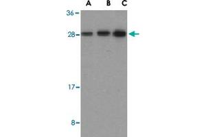 Western blot analysis of BID in mouse lung tissue lysates with BID polyclonal antibody  at (A) 0. (BID Antikörper  (C-Term))