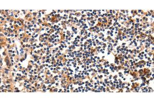 Immunohistochemistry of paraffin-embedded Human tonsil using FADD Polyclonal Antibody at dilution of 1:35 (FADD Antikörper)