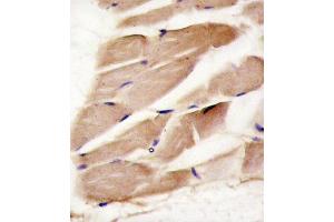 Formalin-fixed and paraffin-embedded human skeletal muscle reacted with PRK antibody (C-term) (ABIN391608 and ABIN2841530) , which was peroxidase-conjugated to the secondary antibody, followed by DAB staining. (PRKAA2 Antikörper  (C-Term))