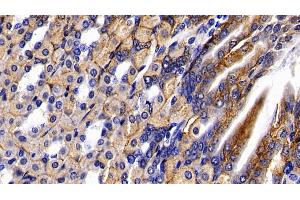 Detection of HEXb in Mouse Stomach Tissue using Polyclonal Antibody to Hexosaminidase B Beta (HEXb)