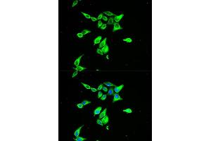 Immunofluorescence analysis of A549 cell using CD55 antibody. (CD55 Antikörper)