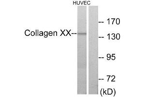 Western Blotting (WB) image for anti-Collagen, Type X, alpha 1 (COL10A1) (C-Term) antibody (ABIN1850314) (COL10A1 Antikörper  (C-Term))