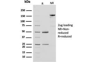 SDS-PAGE Analysis Purified CKBB Mouse Monoclonal Antibody (CPTC-CKB-2). (CKB Antikörper)