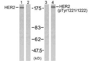 Western blot analysis of extracts from SK-OV3 cells using HER2 (Ab-1221/1222) antibody (E021071, Line 1 and 2) and HER2 (phospho-Tyr1221/Tyr1222) antibody (E011076, Line 3 and 4). (ErbB2/Her2 Antikörper)