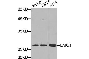 Western Blotting (WB) image for anti-EMG1 Nucleolar Protein Homolog (EMG1) antibody (ABIN1875902) (EMG1 Antikörper)