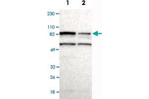 Western Blot analysis of Lane 1: RT-4 and Lane 2: U-251MG sp cell lysates with RPS6KA6 polyclonal antibody . (RPS6KA6 Antikörper)