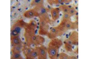 IHC-P analysis of Liver tissue, with DAB staining. (IL1RN Antikörper  (AA 27-178))