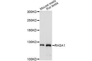 Western blot analysis of extracts of various cell lines, using RASA1 antibody (ABIN1874554) at 1:1000 dilution. (RASA1 Antikörper)