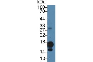 Detection of H3 in Human Cartilage lysate using Polyclonal Antibody to Histone H3 (H3) (Histone 3 Antikörper  (AA 1-136))