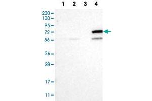 Western Blot analysis of Lane 1: RT-4 cell, Lane 2: U-251 MG sp cell, Lane 3: human plasma tissue (IgG/HSA depleted) and Lane 4: human liver tissue lysates with CYP4F11 polyclonal antibody . (CYP4F11 Antikörper)