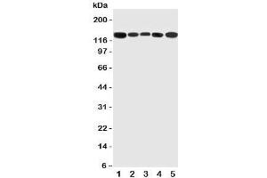Western blot testing of RGS3 antibody and Lane 1:  rat testis;  2: (r) brain;  3: (r) spleen;  4: human HeLa;  5: (h) U87 cell lysate (RGS3 Antikörper  (C-Term))
