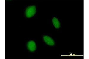 Immunofluorescence of purified MaxPab antibody to ASXL2 on HeLa cell.
