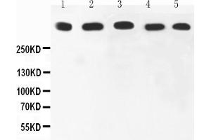 Anti-Ki67 Picoband antibody, All lanes: Anti-Ki67 at 0. (Ki-67 Antikörper  (AA 2860-3256))
