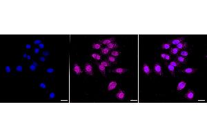 Immunocytochemical staining of HepG2 cells with ALKBH1 antibody (ABIN7797579), 1:1,000). (Rekombinanter ALKBH1 Antikörper)