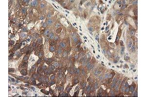 Image no. 1 for anti-Breast Cancer Anti-Estrogen Resistance 1 (BCAR1) antibody (ABIN1496834) (BCAR1 Antikörper)
