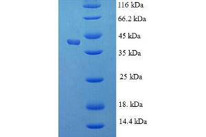 SDS-PAGE (SDS) image for Kallikrein 1 (KLK1) (AA 25-262) protein (His-SUMO Tag) (ABIN5709809) (Kallikrein 1 Protein (KLK1) (AA 25-262) (His-SUMO Tag))