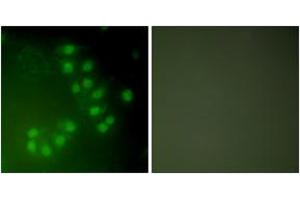 Immunofluorescence analysis of A549 cells, using p63 Antibody. (TCP1 alpha/CCTA Antikörper  (AA 631-680))