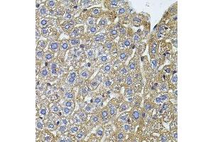 Immunohistochemistry of paraffin-embedded mouse liver using CETP antibody.