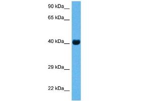 Host:  Rabbit  Target Name:  CKM  Sample Tissue:  Mouse Skeletal Muscle  Antibody Dilution:  1ug/ml (CKM Antikörper  (N-Term))
