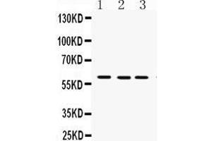 Western Blotting (WB) image for anti-Flavin Containing Monooxygenase 3 (FMO3) (AA 404-433), (C-Term) antibody (ABIN3043830)