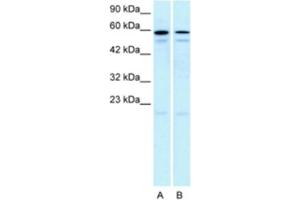 Western Blotting (WB) image for anti-5-Hydroxytryptamine (serotonin) Receptor 2C (HTR2C) antibody (ABIN2463752) (HTR2C Antikörper)